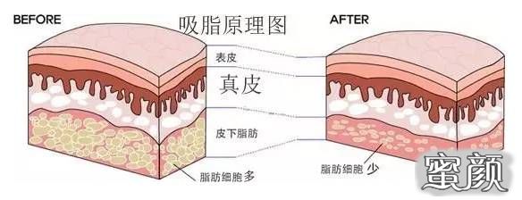 案例图片