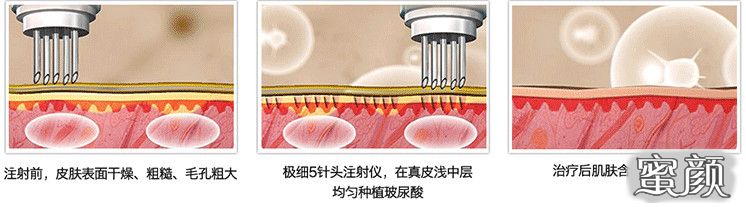 案例图片