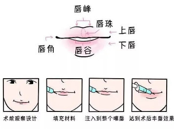 案例图片