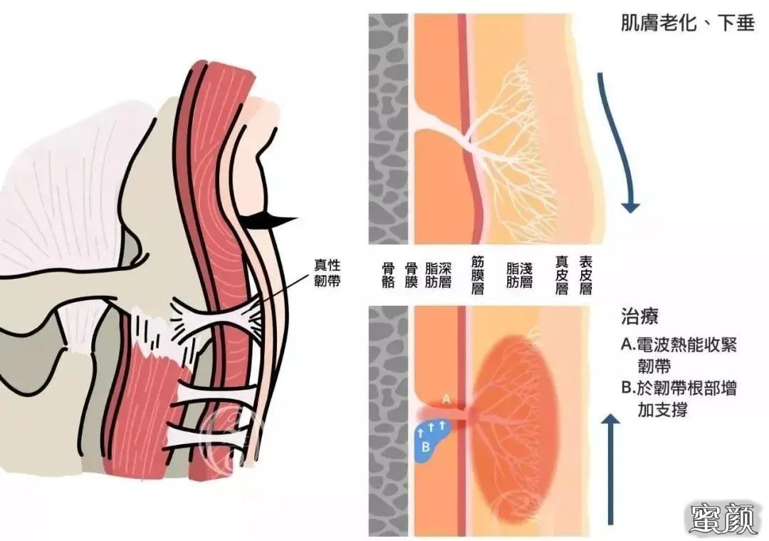 案例图片