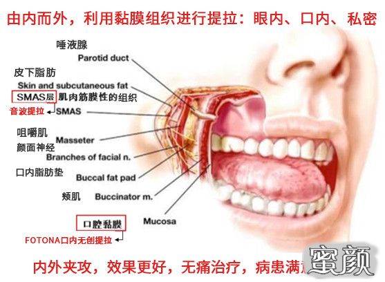 案例图片