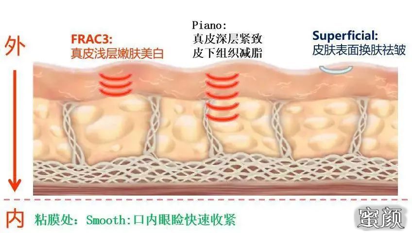 案例图片