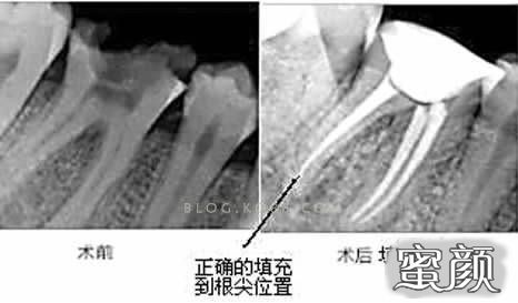 案例图片