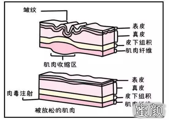 案例图片