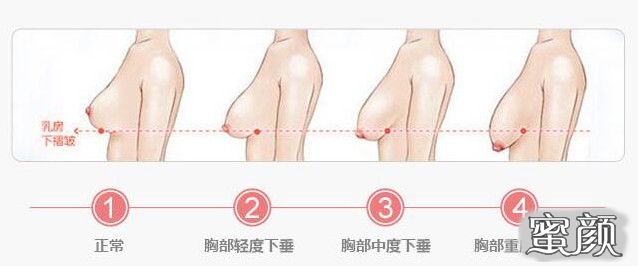 案例图片