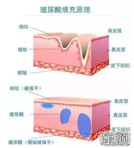 案例图片