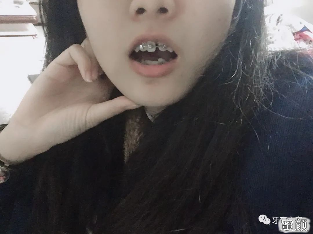 https://img.yiyiaimei.com/mnt/timg/210125/0911214548-9.jpg