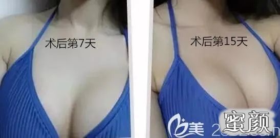 案例图片