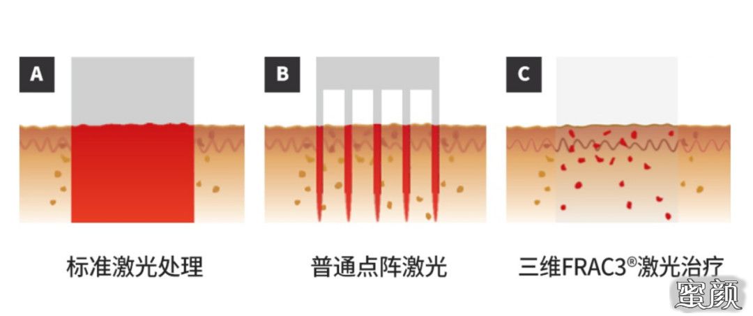 案例图片