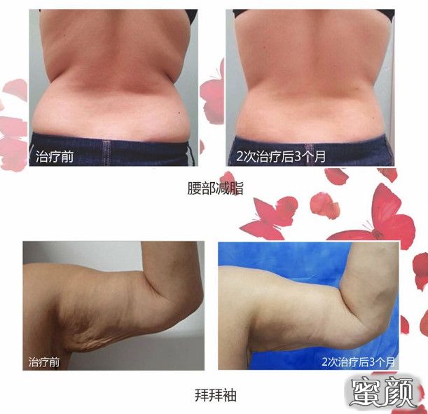 https://img.yiyiaimei.com/mnt/timg/210126/213AI318-3.jpg