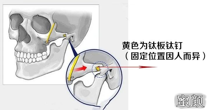 案例图片