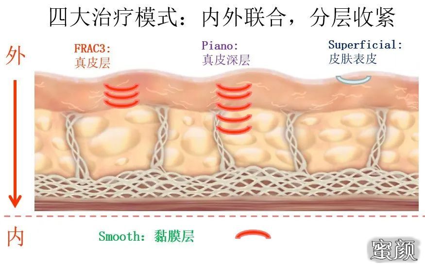 案例图片