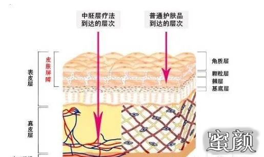 案例图片