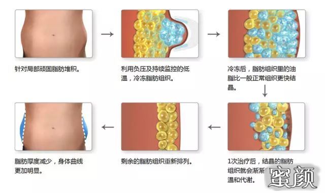 https://img.yiyiaimei.com/mnt/timg/210128/0S0251202-3.jpg