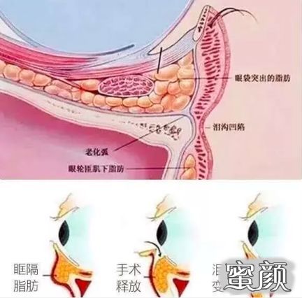 案例图片