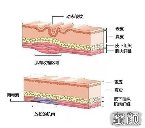 案例图片