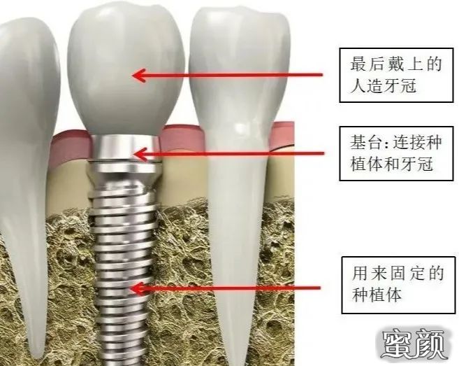 案例图片