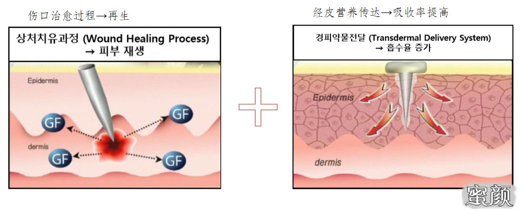 案例图片