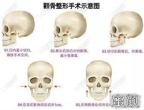 案例图片