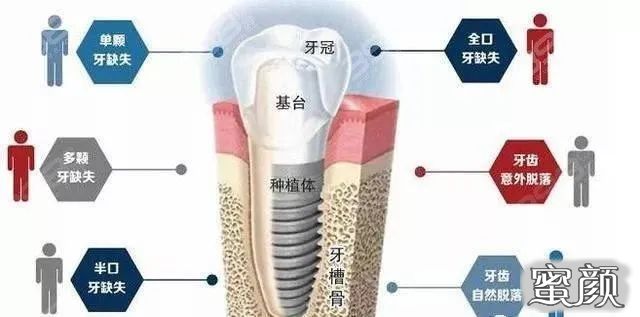 案例图片