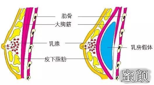 案例图片