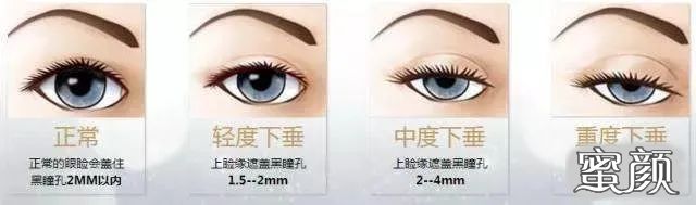 https://img.yiyiaimei.com/mnt/timg/210130/1551142H5-5.jpg
