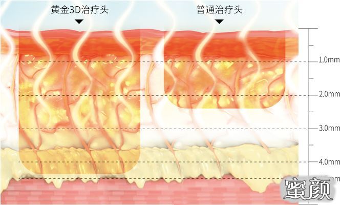 https://img.yiyiaimei.com/mnt/timg/210130/20231LN3-10.jpg