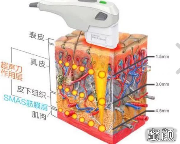 https://img.yiyiaimei.com/mnt/timg/210130/20231V034-14.jpg