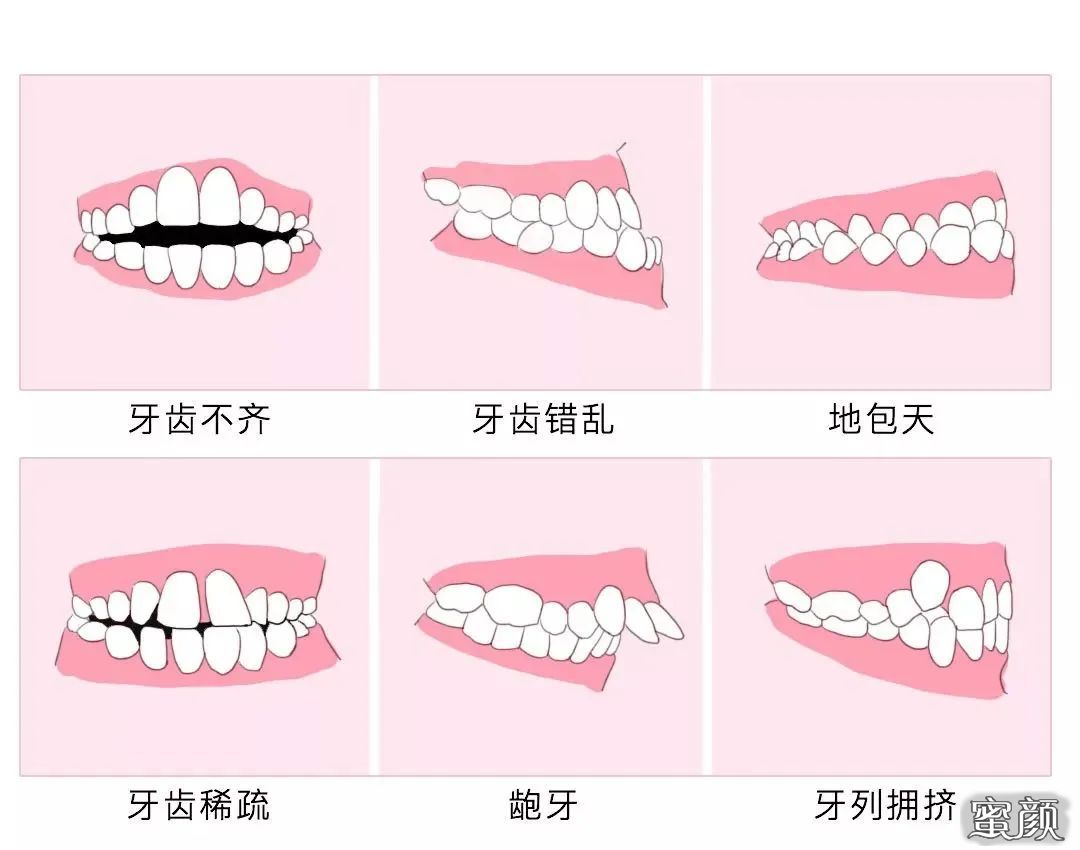 案例图片