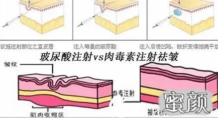 案例图片