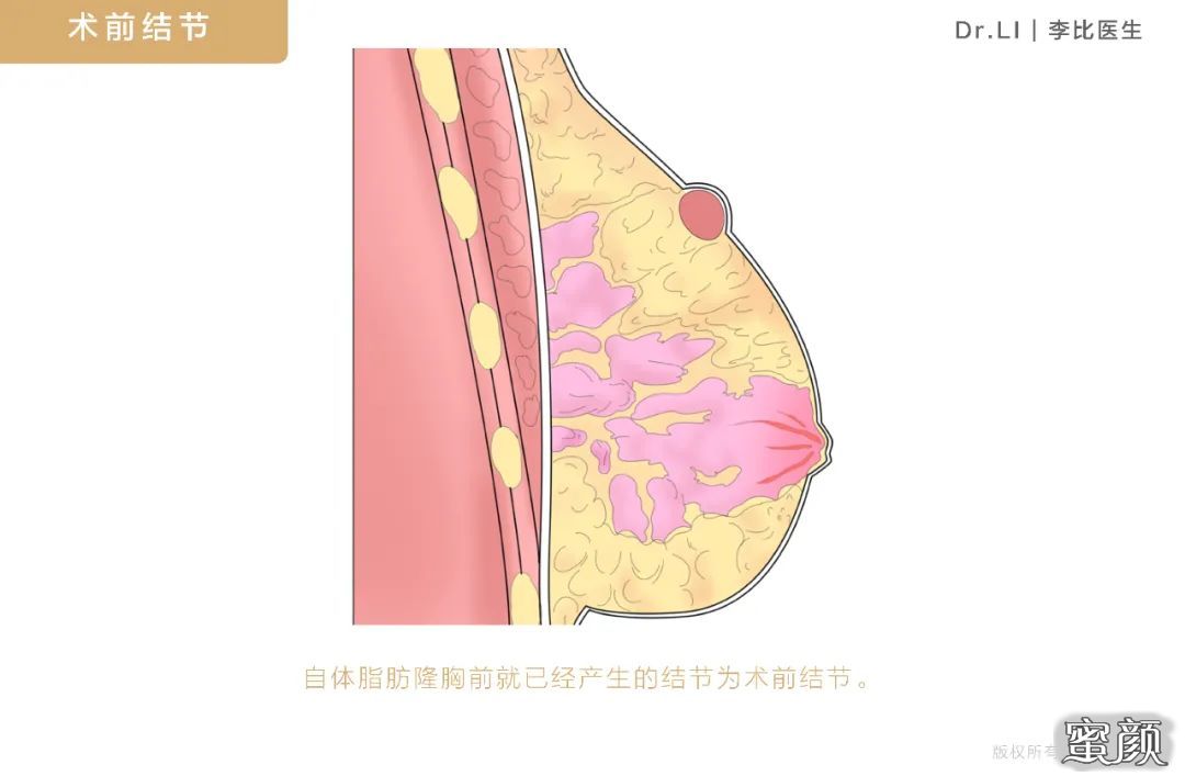 案例图片