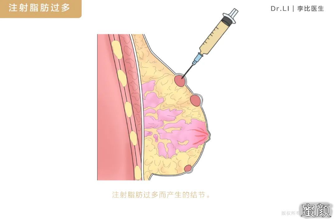 案例图片