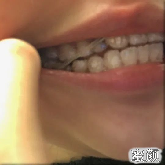 案例图片