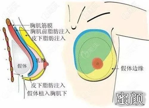 案例图片