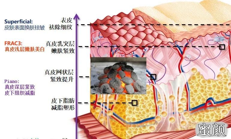 案例图片