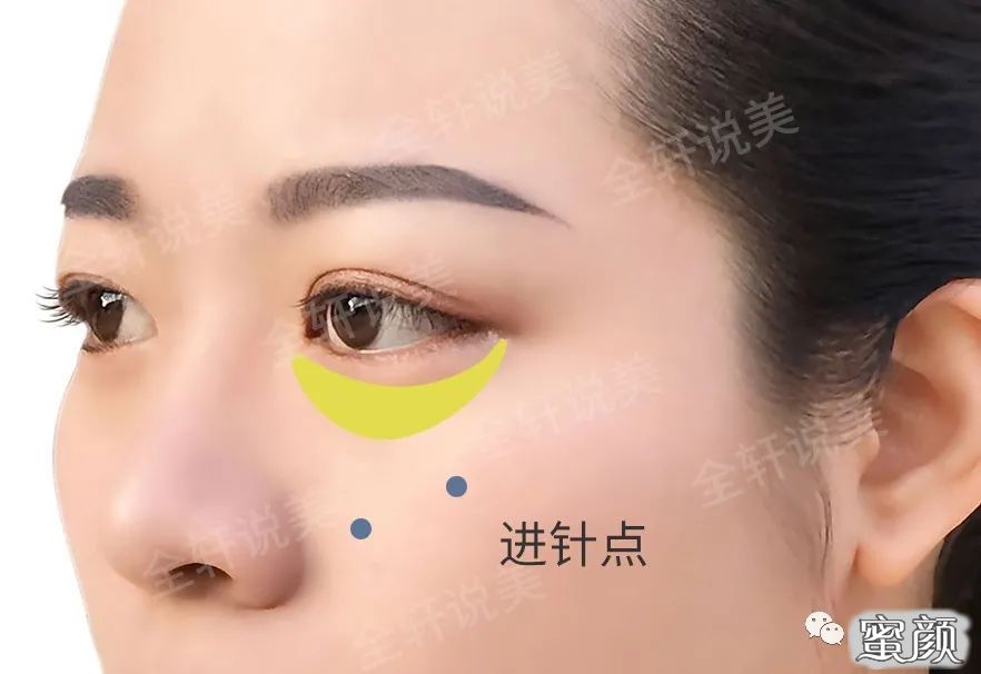 案例图片