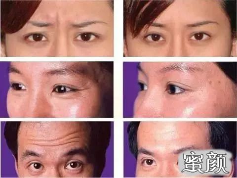 https://img.yiyiaimei.com/mnt/timg/210201/22422340F-1.jpg