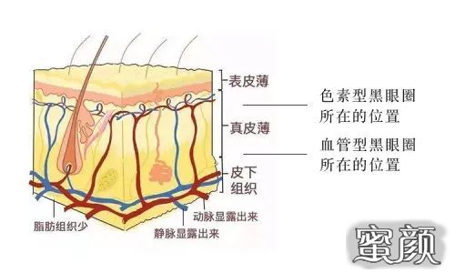 案例图片