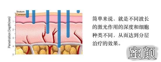 案例图片