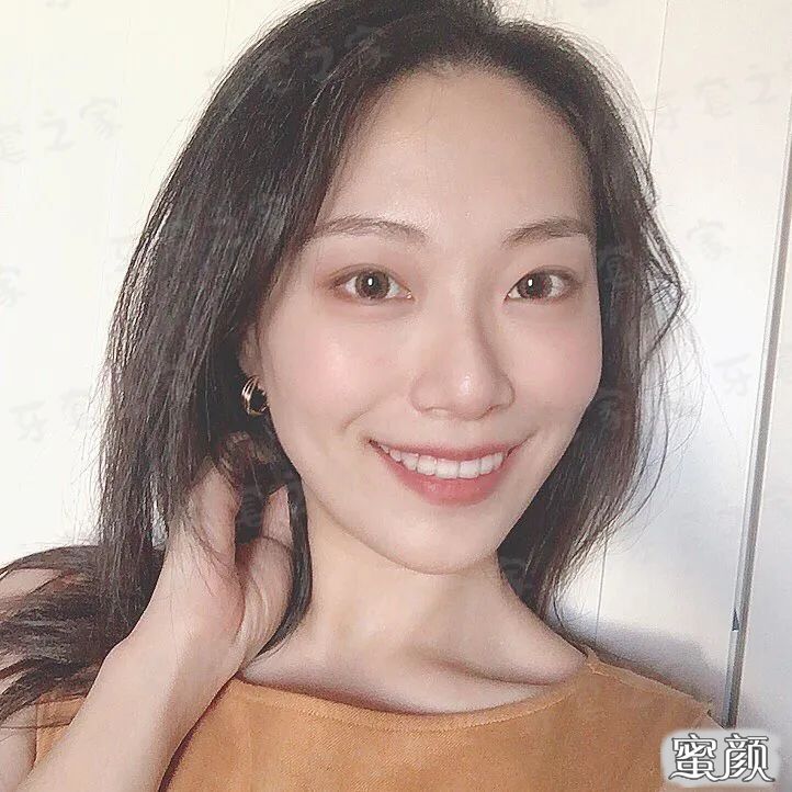 案例图片