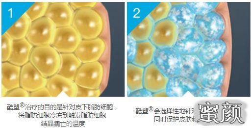 案例图片