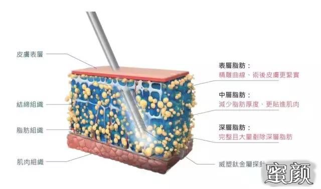 案例图片