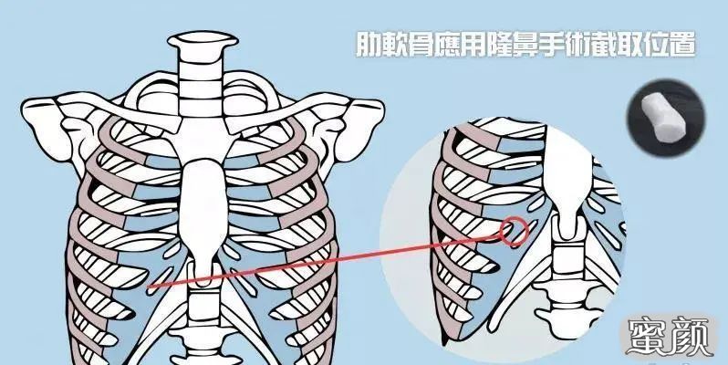 案例图片