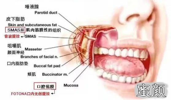 案例图片