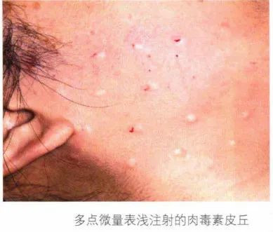 案例图片