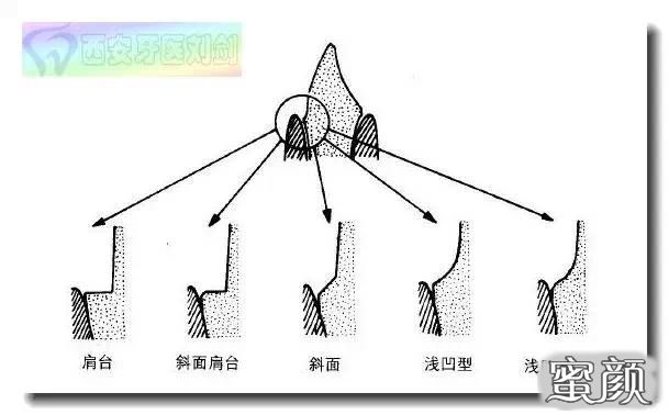 案例图片