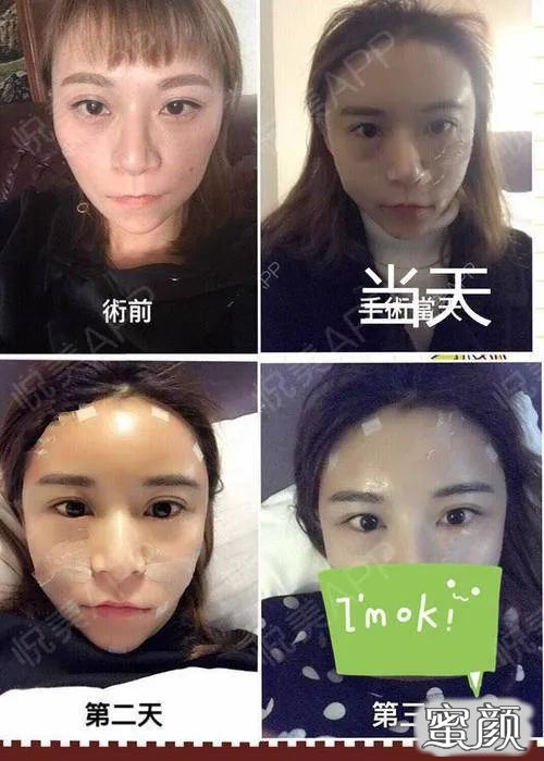案例图片