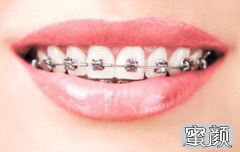 案例图片