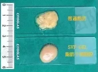 案例图片