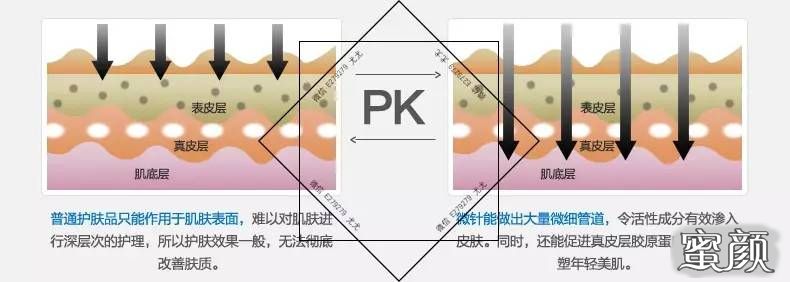 案例图片